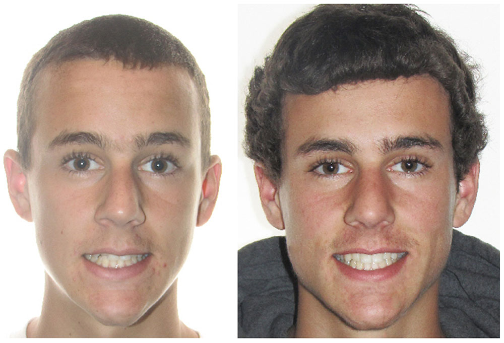 Levittown Smile Design