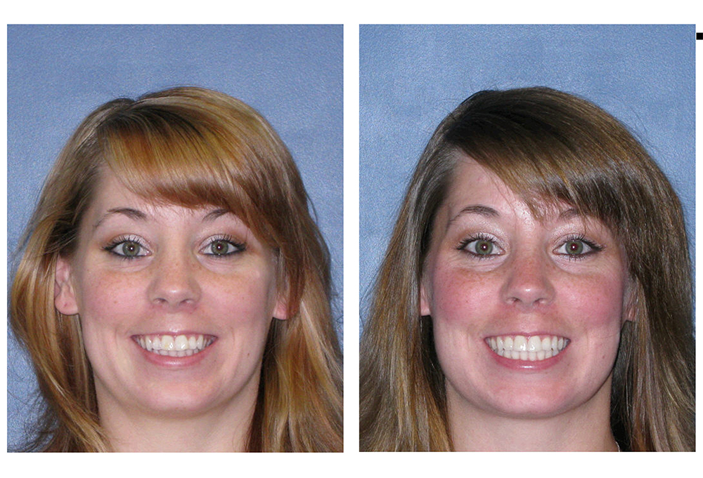 Levittown Smile Design