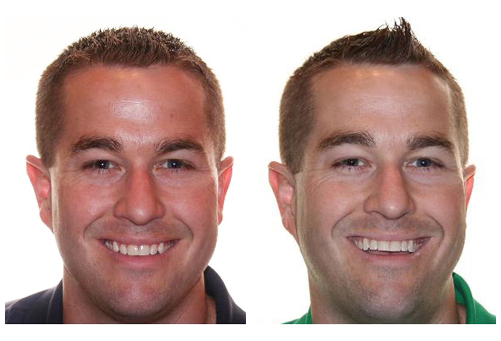 Levittown Smile Design