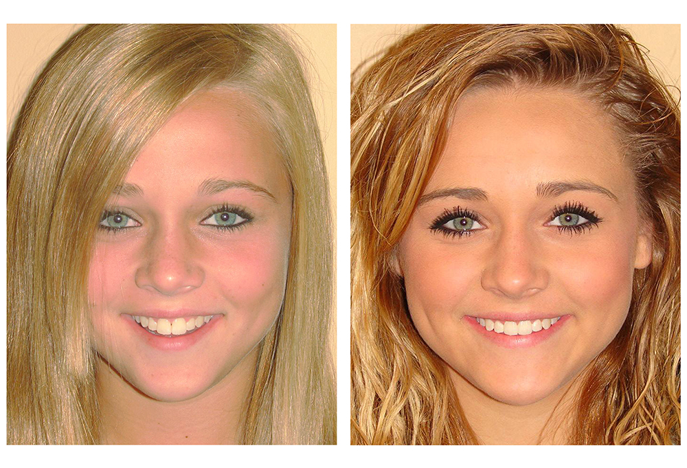 Levittown Smile Design