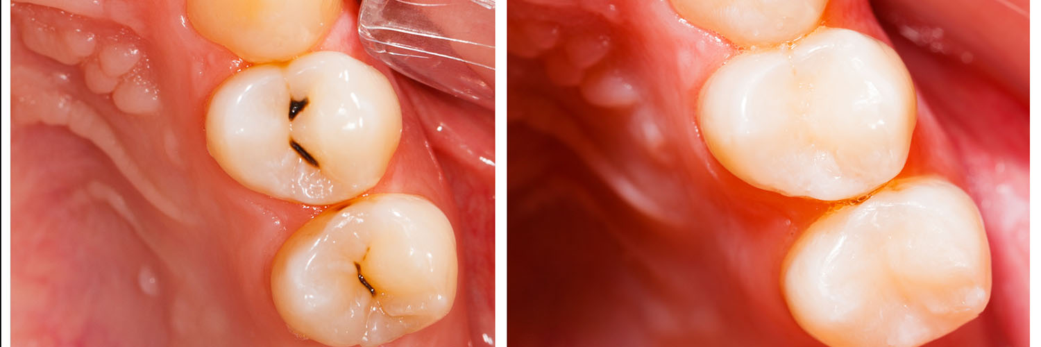 Levittown Smile Design