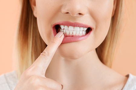Levittown Smile Design